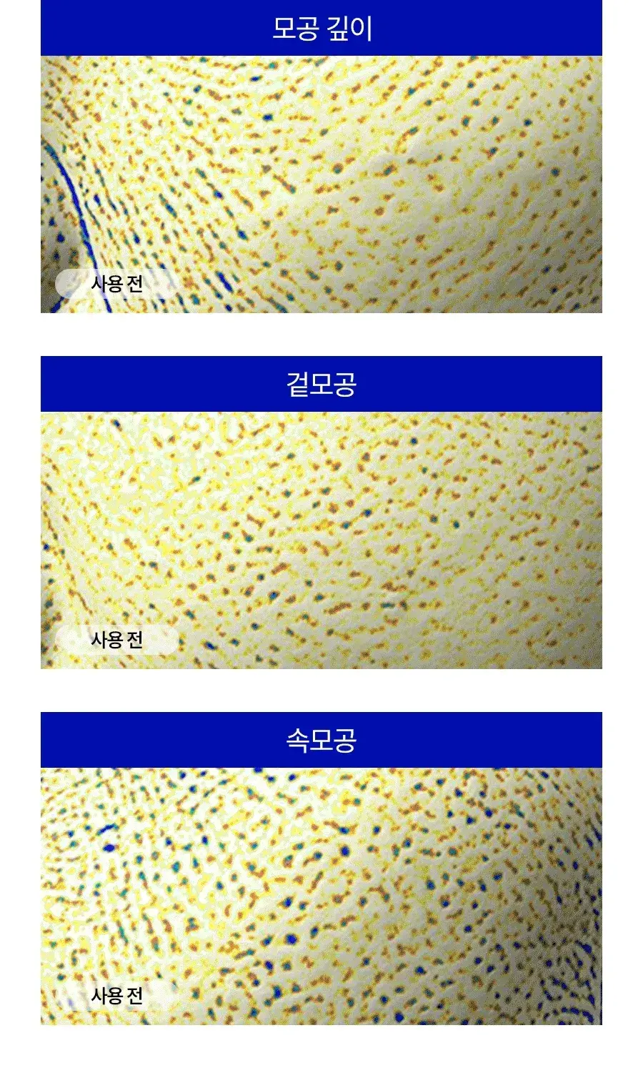 [모공플럼핑 수분앰플] 메디필 히알루론산 레이어 물톡스 앰플 더블 기획 30ml+30ml 상세페이지 11